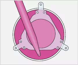 Asymetric positioning for comfortable access to the cultivation vessel.